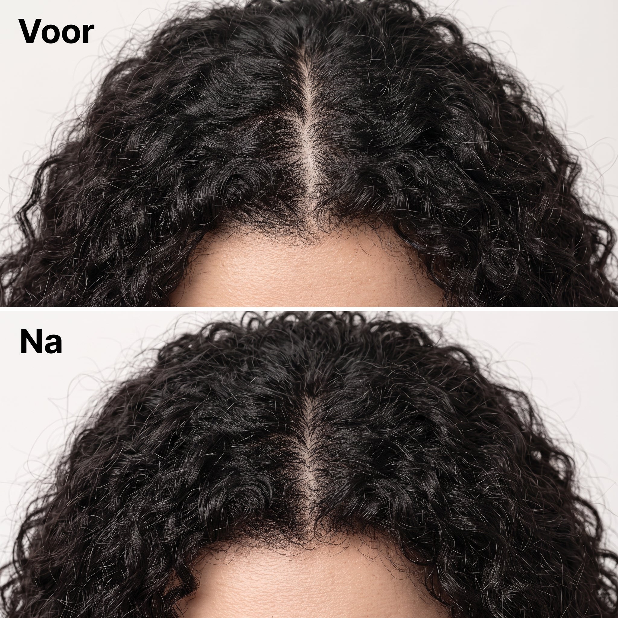 Korean Scalp Revival Bar