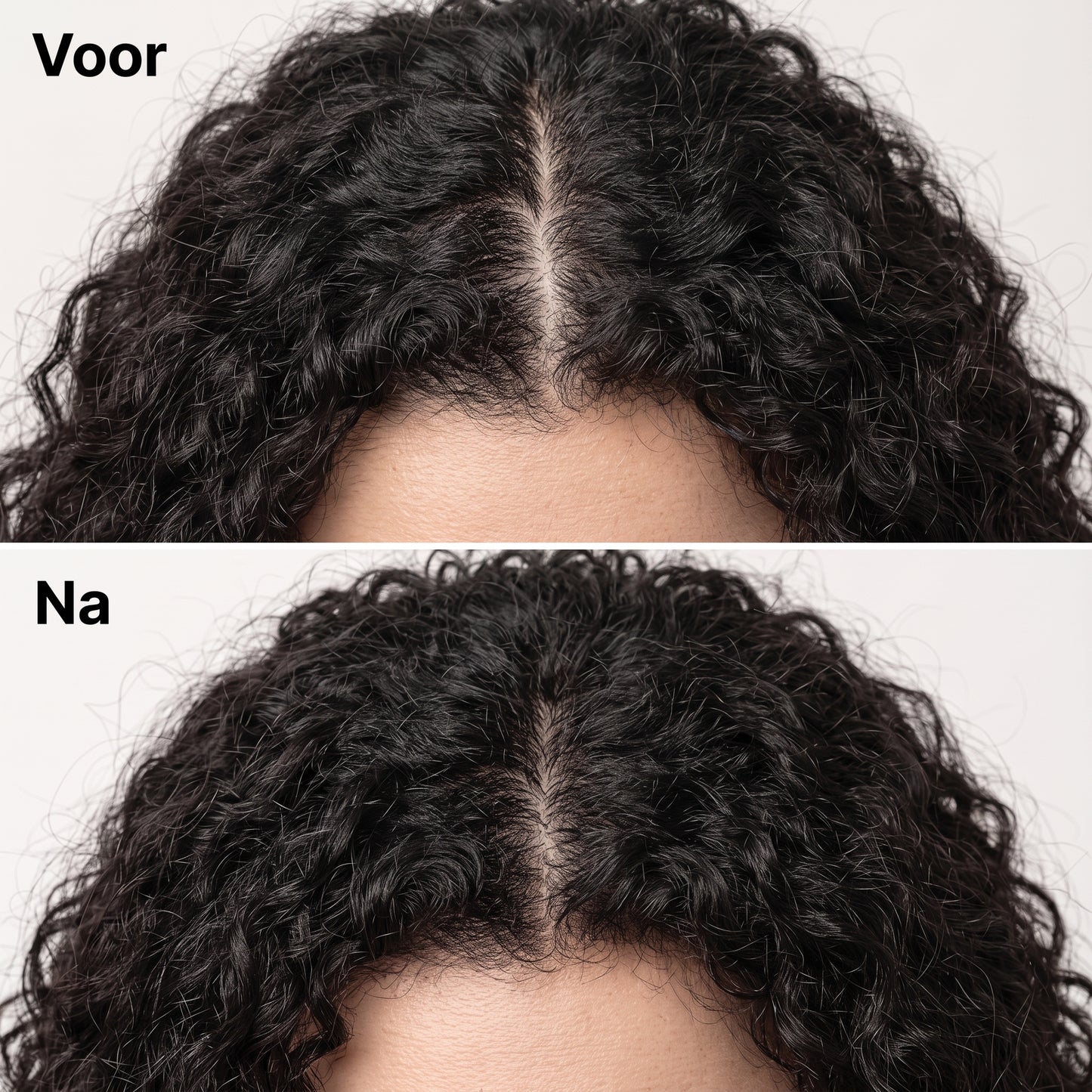 Korean Scalp Revival Bar