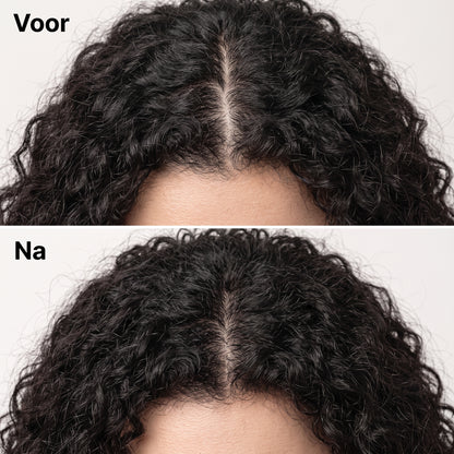 Korean Scalp Revival Bar
